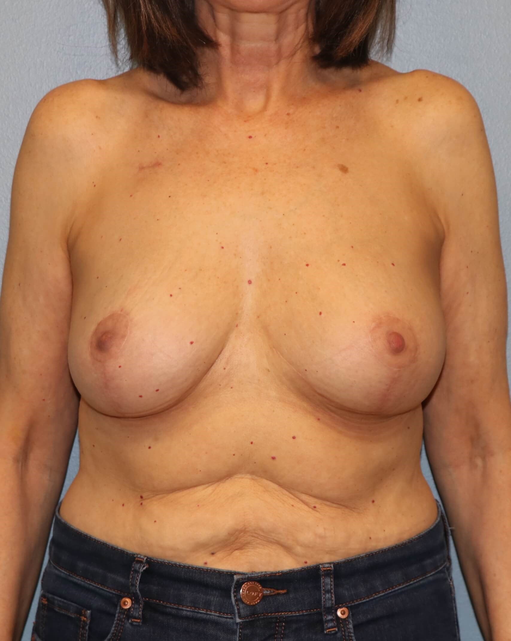 After Image