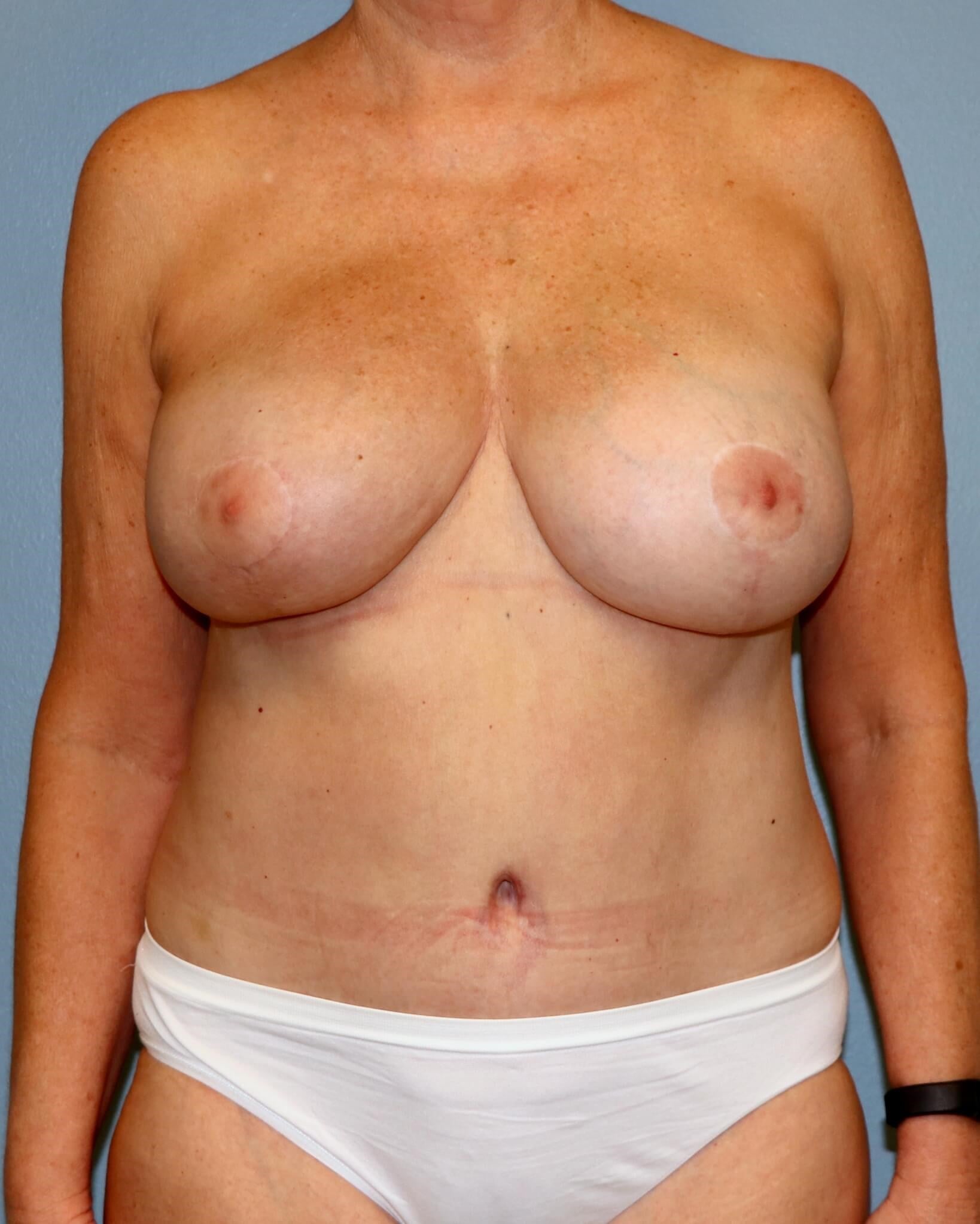 After Image