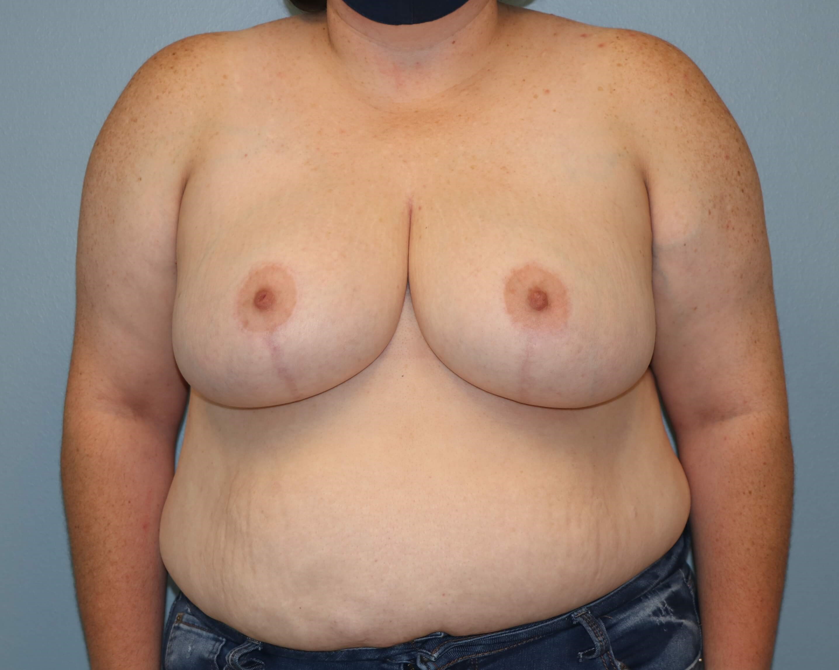 After Image