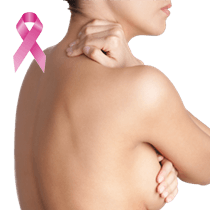 Lumpectomy Reconstruction